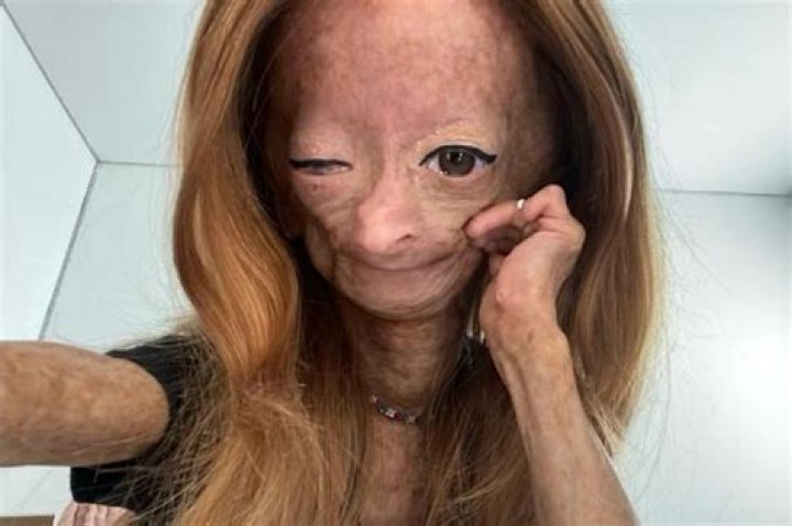 Adalia Rose Adalia Rose